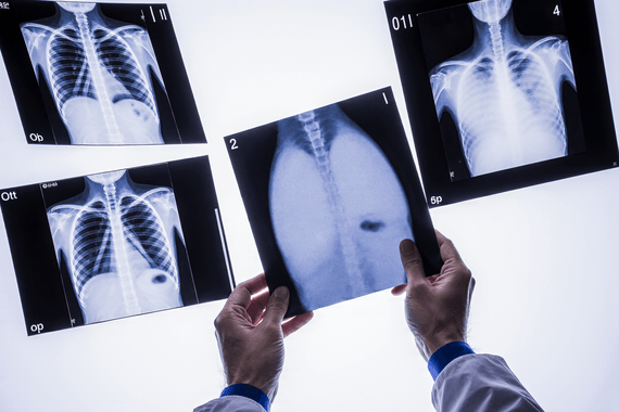 Гендиректор крупнейшей в США системы госбольниц объявил о готовности заменить радиологов ИИ